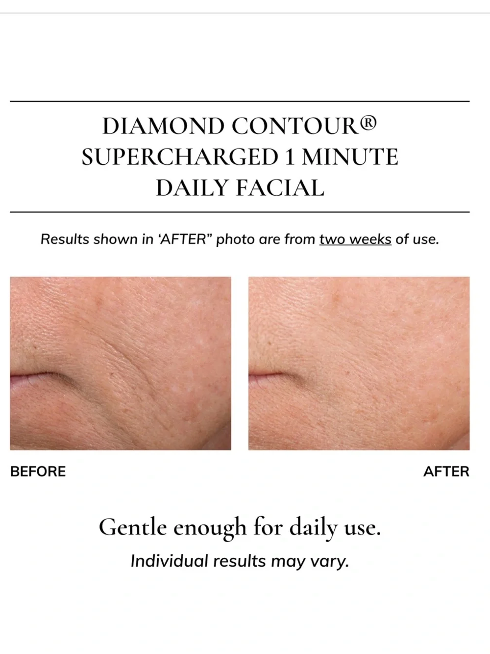 Kaplan MD Diamond Contour Supercharged 1 Minute Daily Facial 6oz/180ml